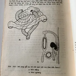 Bài giảng điệu trị học ngoại khoa, Trương Công Trung-Nguyễn Đình Hối 710631