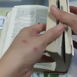 [MIỄN PHÍ BỌC SÁCH] Từ Điển Y Học Anh - Việt (English - Vietnamese Medical Dictionary) 727387