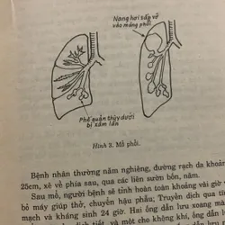 Tìm hiểu và chữa trị bệnh ngoại khoa, bác sĩ Văn Tần 709184