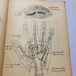 PHẪU THUẬT BÀN TAY BẰNG HÌNH VẼ ATLAS - 176 trang, nxb: 1987  363211