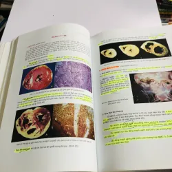 BÀI GIẢNG LÝ THUYẾT GIẢI PHẪU BỆNH  780441