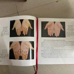 Chuẩn đoán bệnh qua vân tay 585366