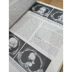 Heart disease - Braunwald 565086