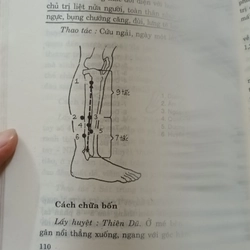 Thủ Pháp Châm Cứu Chữa Bệnh- Tôn Giáp Điền- Lương Lập Vũ - Từ Kế Tín 530685