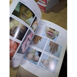 Tạp chí khoa học tiêu hóa việt nam tậpVI số 22 mới 90% 2011 HCM0808 TẠP CHÍ, THIẾT KẾ, THỜI TRANG 923673