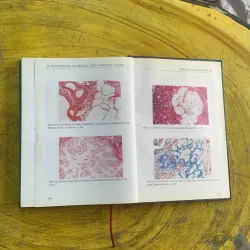 ATLAS MÔ BỆNH HỌC CÁC BỆNH CẦU THẬN & BỆNH ỐNG - KẼ THẬN 1009009