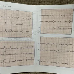 Bài tập điện tâm đồ- M. ENGLERT - R. BERNARD - Dùng cho sinh viên y khoa và bác sỹ 933850
