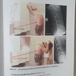 KỸ THUẬT CHỤP X QUANG 738448