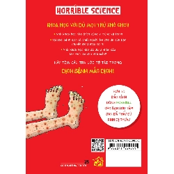 Horrible Science - Dịch Bệnh Mắc Dịch - Nick Arnold, Tony De Saulles 294849