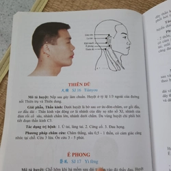 Học châm cứu bằng hình ảnh Lê Quý Ngưu 447079