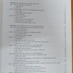 CẤY GHÉP NHA KHOA 740877