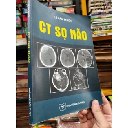 CT sọ não - Lê Văn Phước 738449