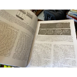 Pellock's Pediatric Epilepsy: Diagnosis and Therapy 760498