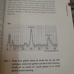 BỆNH HUYẾT SẮC TỐ- Giáo sư Bác sỹ Nhật Teruo Harano SYSMEX CORP. 778131