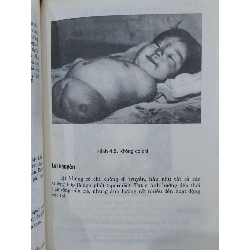 Dị dạng bẩm sinh - GS.TS. Trịnh Văn Bảo 799373