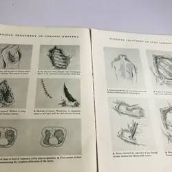 MANUAL OF OPERATIVE PROCEDURE AND SURGICAL KNOTS 700910