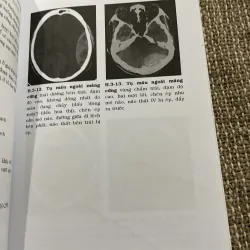 CT chấn thương đầu - PGS. PHẠM NGỌC HOA ThS. LÊ VẤN PHƯỚC; 150 trang khổ lớn  1021342