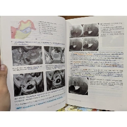 Y học sinh sản đại cương - Vương Thị Ngọc Lan, Âu Nhựt Luân 746055