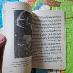 Chẩn đoán siêu âm các bệnh tim mạch 971636