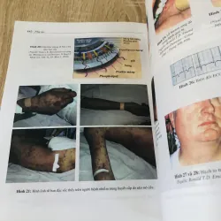 BỆNH TRUYỀN NHIỄM  996071