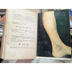 Cẩm nang y học toàn khoa - Bác Sĩ Nguyễn Hoàng Mai 137660