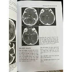 CT sọ não - Lê Văn Phước 738449