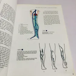 KHÁM PHÁ BỆNH SUY TĨNH MẠCH MẠN TÍNH 707200