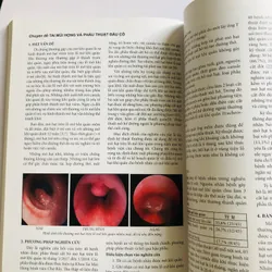 📚 2 TẬP CHUYÊN ĐỀ TAI - MŨI - HỌNG VÀ PHẪU THUẬT ĐẦU CỔ 593152