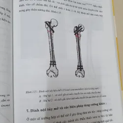 CHAN THƯƠNG HỌC VÙNG HÁNG  1024134