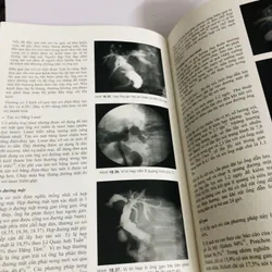 📘 SỎI ĐƯỜNG MẬT – Nguyễn Đình Hối & Nguyễn Mậu Anh 700887