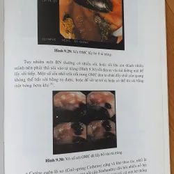 NỘI SOI MẶT TUY  754032