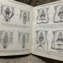 Kthuật phẫu thuật bằng hình ảnh -TECHNIQUE CHIRURGIEALE EN FIGURES G.JEANNENEY& J.MAGENDIE 1006345