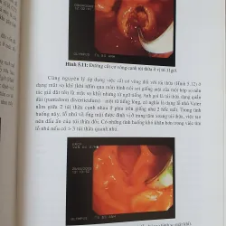 NỘI SOI MẶT TUY  754032