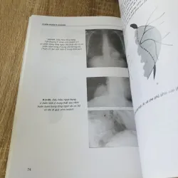 BÀI GIẢNG CHẨN ĐOÁN X QUANG 1004284