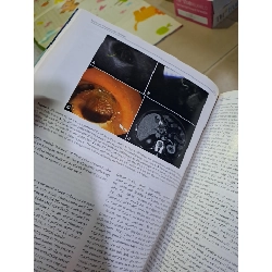 GIE Gastrointestinal Endoscopy volume 86 no 4 10/2017 HCM0808 TẠP CHÍ, THIẾT KẾ, THỜI TRANG 527157