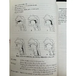 Viêm họng amidam và VA - PGS,TS. Nguyễn Hữu Khôi 719525