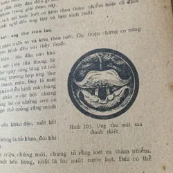 Tai mũi họng thực hành, hình vẽ minh hoạ, Võ Tấn 608499