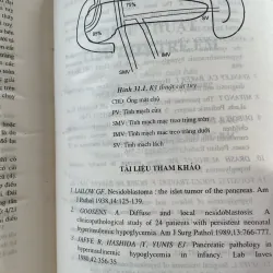 Phẫu thuật tiêu hóa trẻ em - Ts Lê Thanh Liêm ; gần 400 trang  1025098