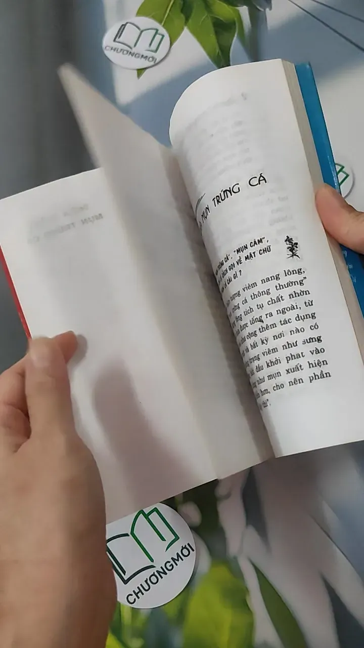 Chiến Thắng Mụn Trứng Cá - Kim Trọng 780823