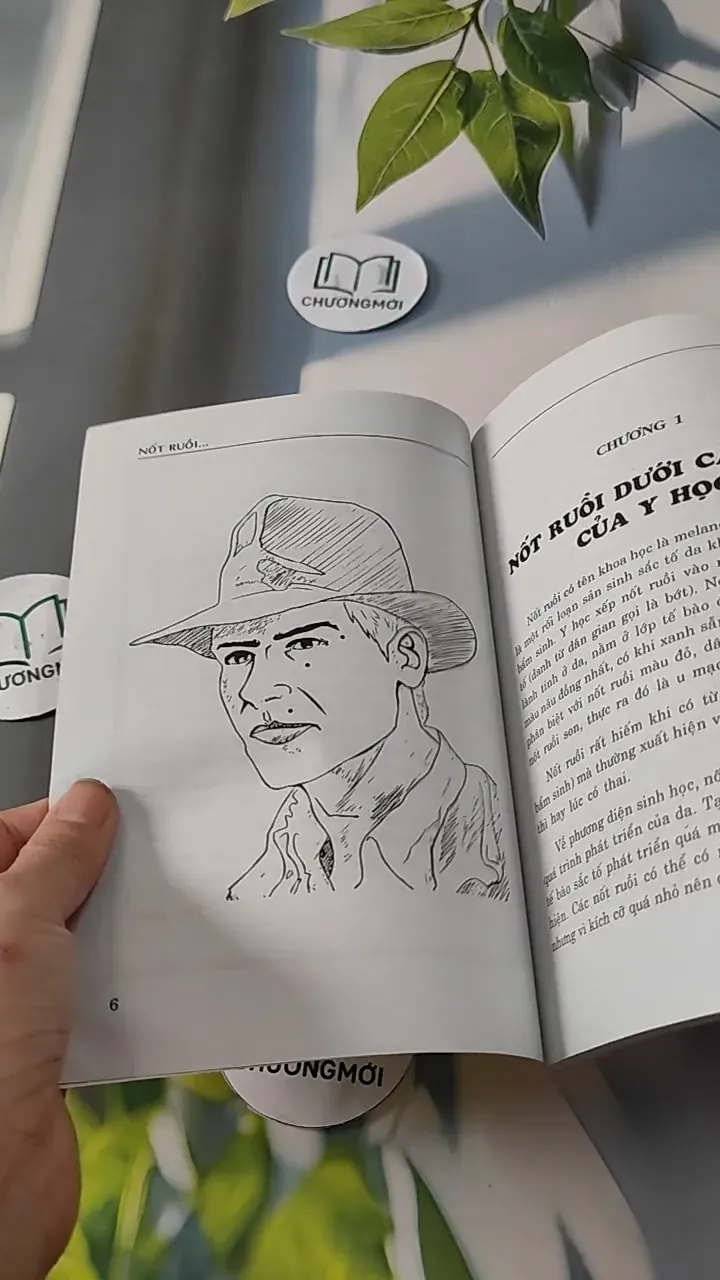 Nốt Ruồi Dưới Cái Nhìn Y Học & Tướng Học - Như Hùng 727280