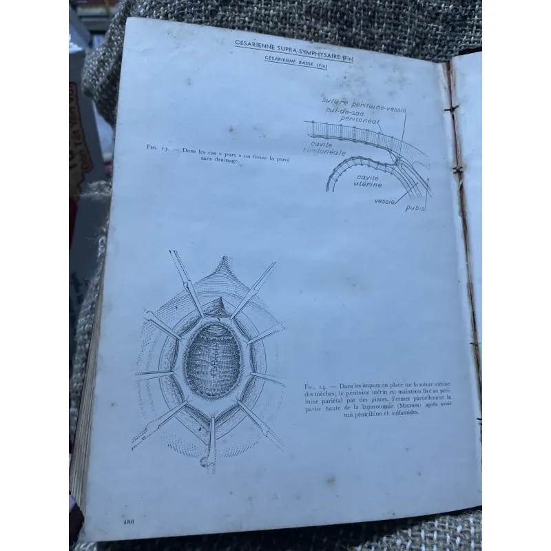Kthuật phẫu thuật bằng hình ảnh -TECHNIQUE CHIRURGIEALE EN FIGURES G.JEANNENEY& J.MAGENDIE 1006345