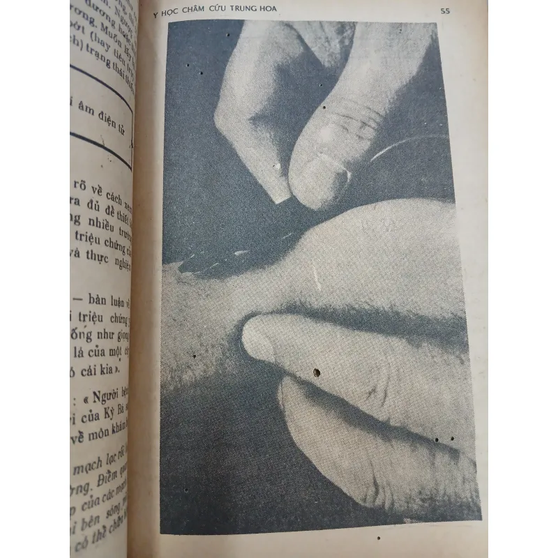 Y HỌC CHÂM CỨU TRUNG HOA - HÀNG THANH 754274