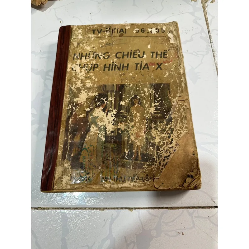 Những chiều thế chụp hình tia x 728307