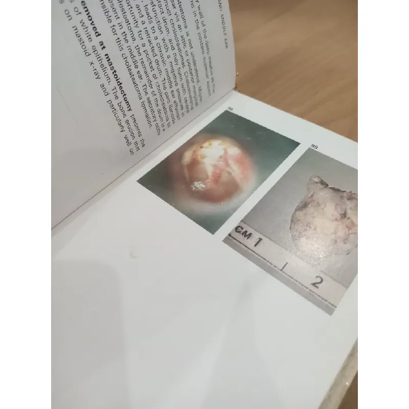 A colour atlas of E. N. T. Diagnosis - T. R. Bull 553141