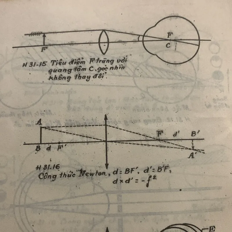 Nhãn khoa lâm sàng, Ngô Như Hoà chủ biên, lưu hành nội bộ 709169