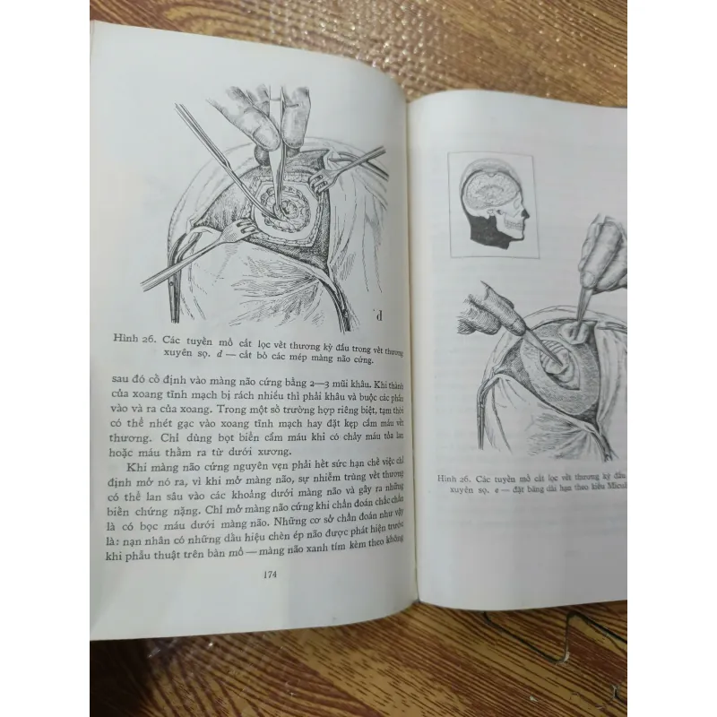 Ngoại khoa dã chiến 1009417