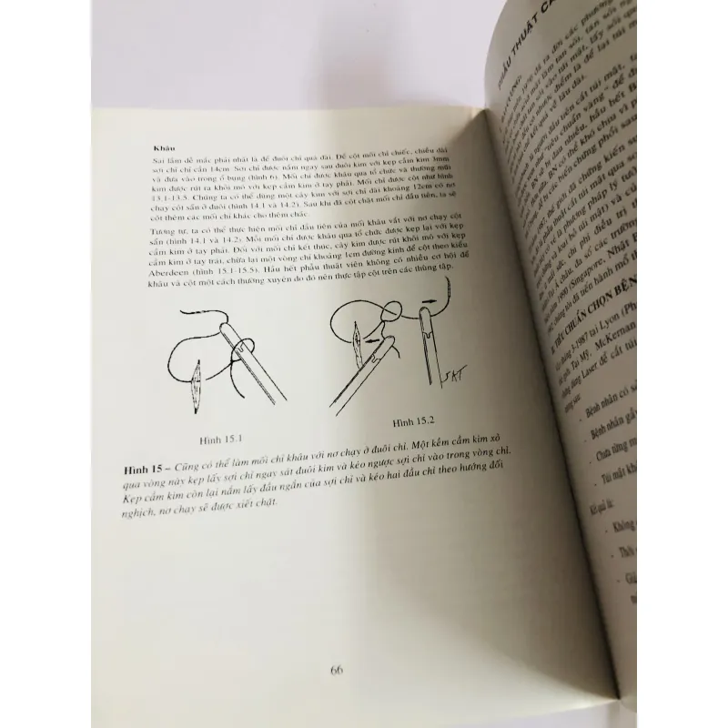 TÀI LIỆU HƯỚNG DẪN PHẪU THUẬT NỘI SOI 780444