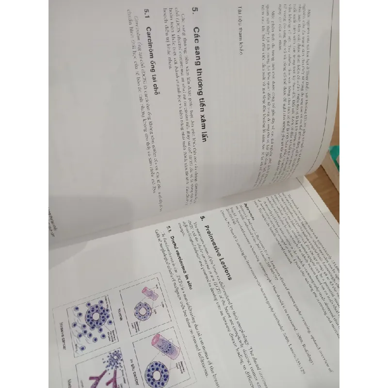Module 11: Breast Cancer - E. Stickeler, D. Watermann 703649