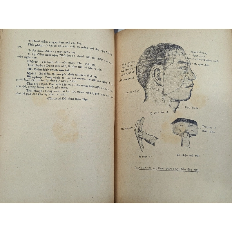 Cấp cứu trị bệnh phổ thông - Thượng Trúc 130130