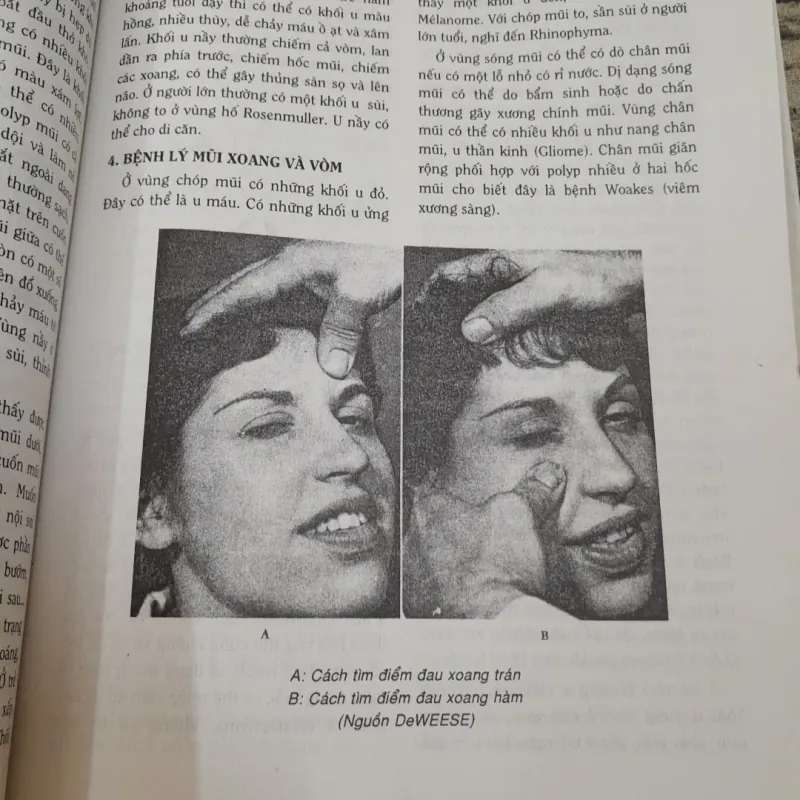 TAI MŨI HỌNG NHẬP MÔN- Phó GS Tiến sỹ NHAN TRỪNG SƠN. 788006